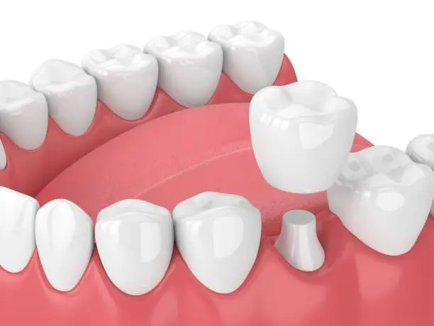 Heinle Dental