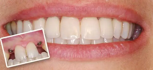 All Brite Dentistry