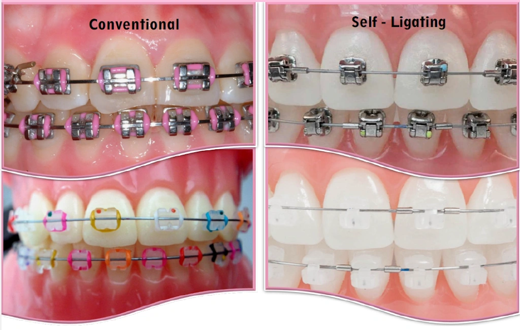 All Brite Dentistry