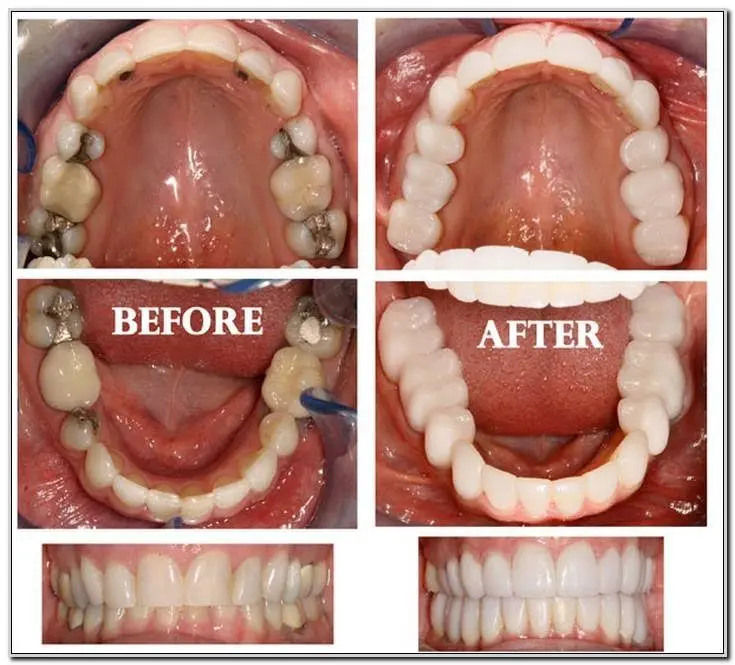 All Brite Dentistry