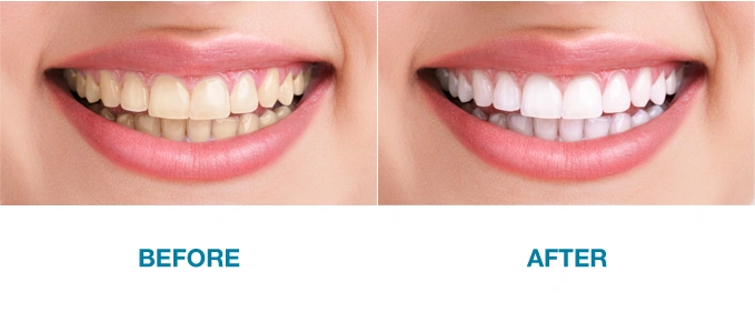 All Brite Dentistry