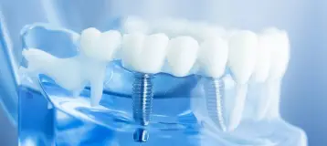 Beyond Periodontics