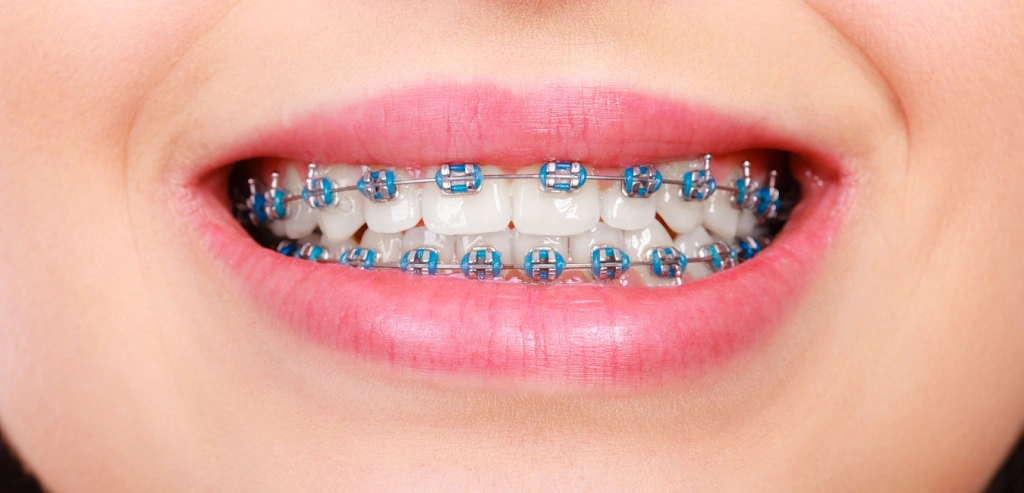 Lakeside Family Dental
