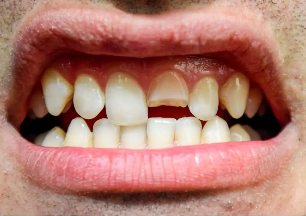 Dentist On Washington Crossing