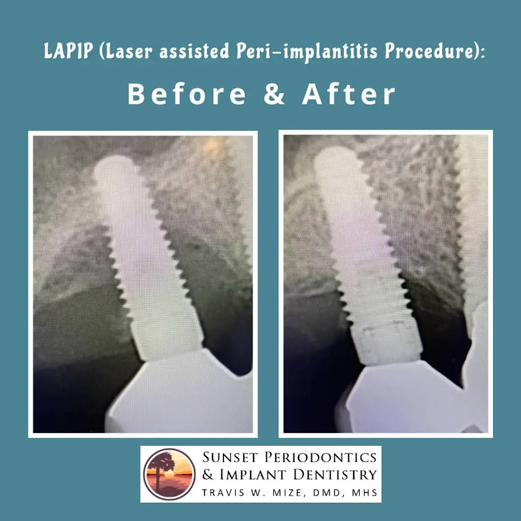 Sunset Periodontics & Implant Dentistry