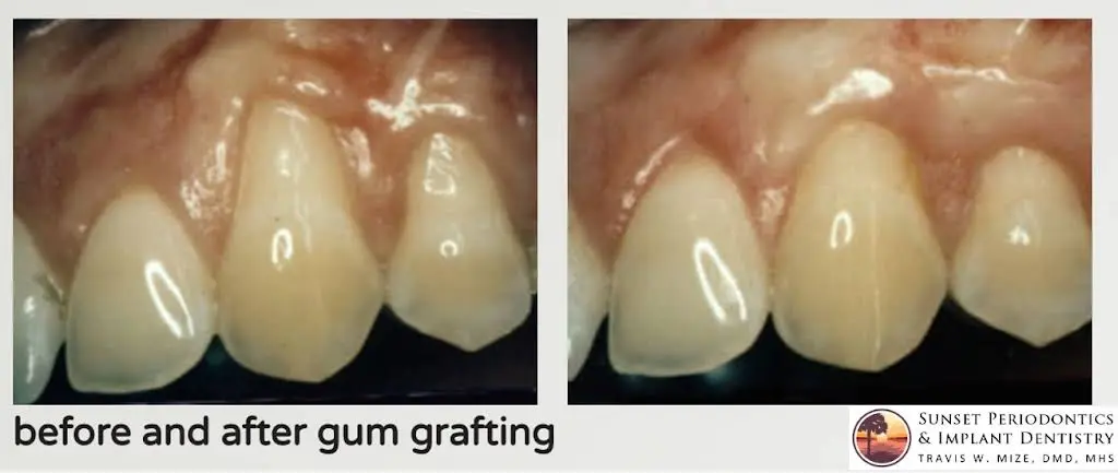 Sunset Periodontics & Implant Dentistry