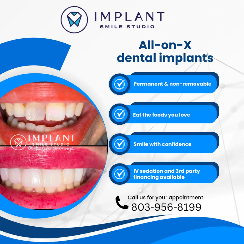 Implant Smile Studio