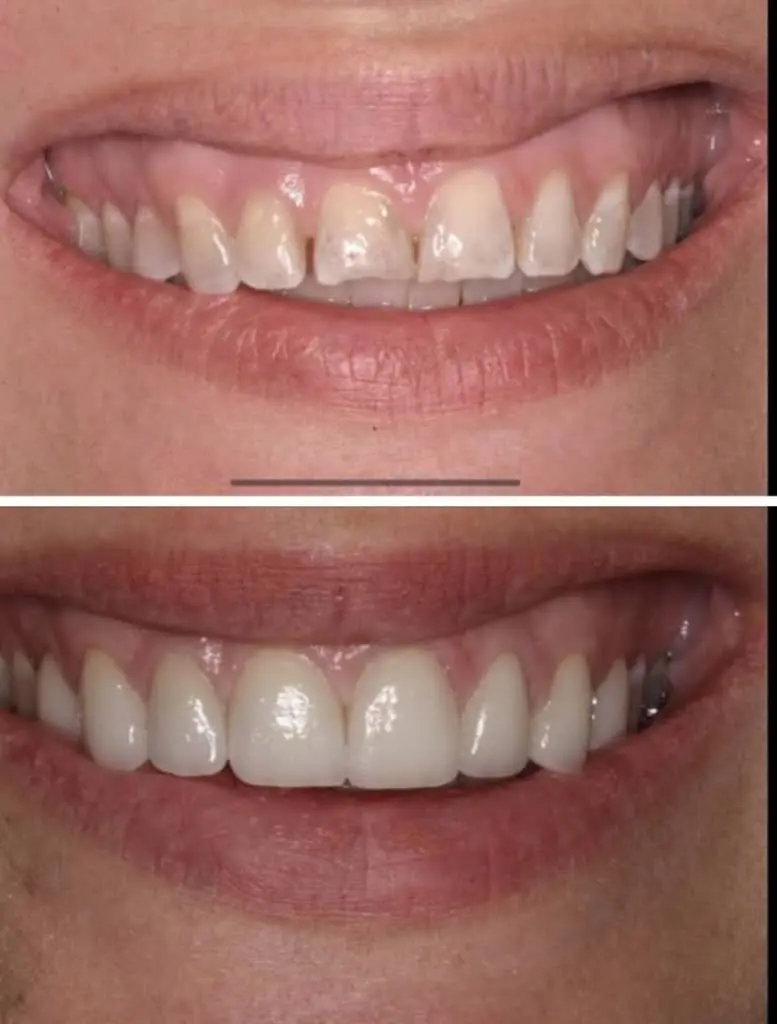 Infinity Dental Associates