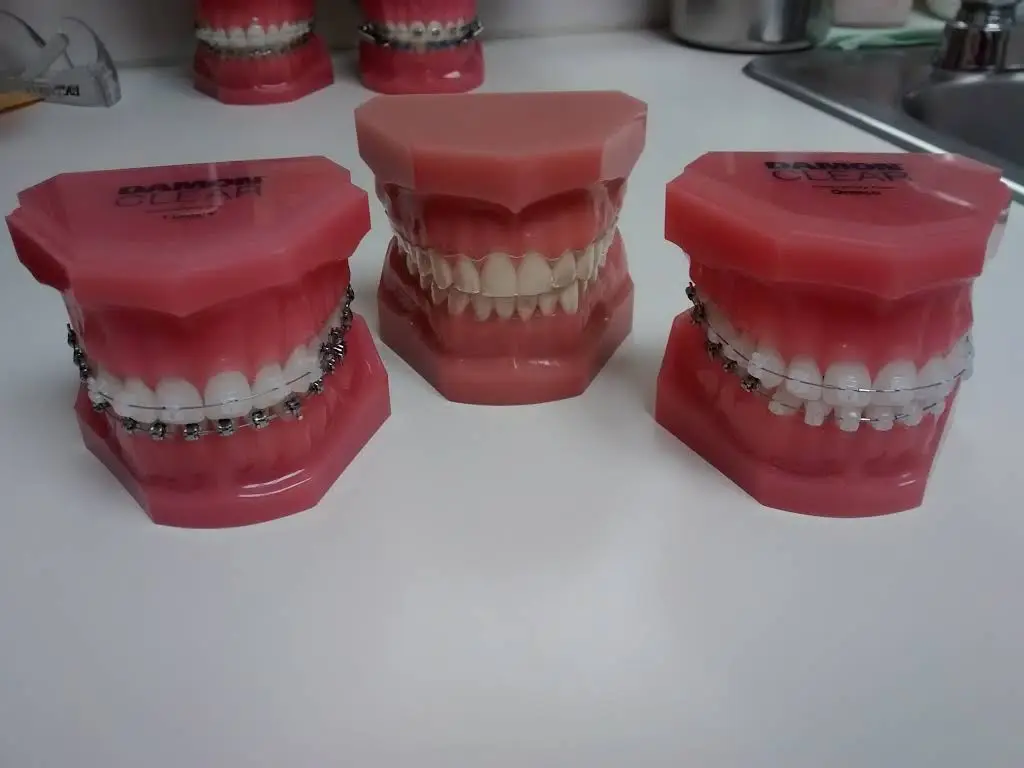 White Brown Smiles