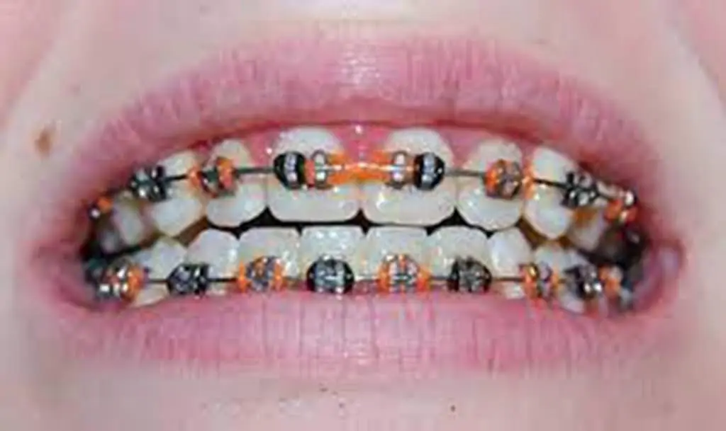 Cox Orthodontics