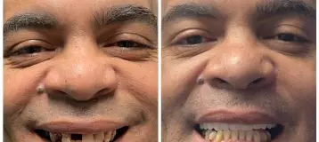 Signature Smile Dental Implant Center