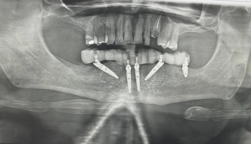 Signature Smile Dental Implant Center
