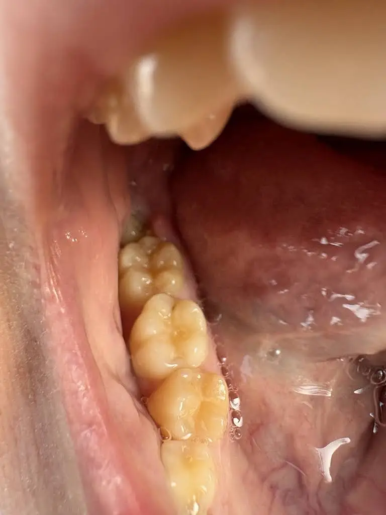 Dental Solutions of Deptford