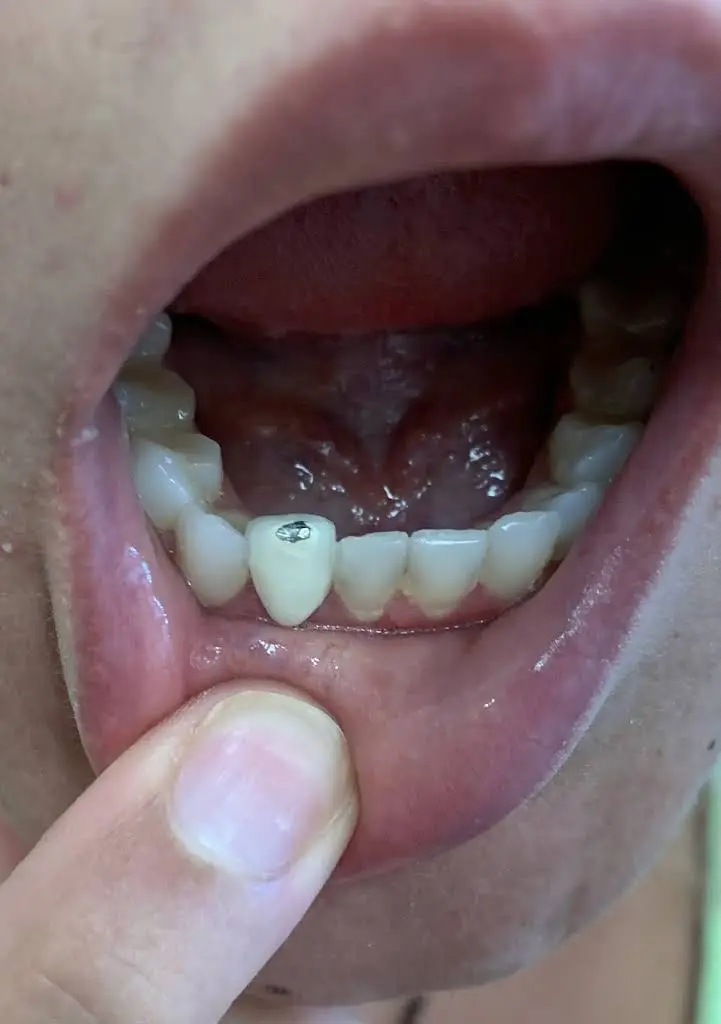 Dental Solutions of Blackwood