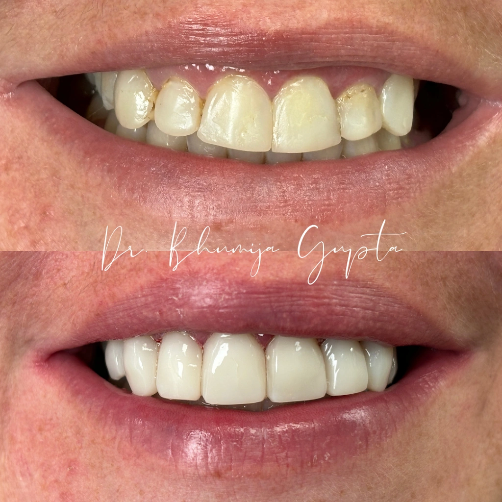 BG Dental Wellness and Cosmetic Center