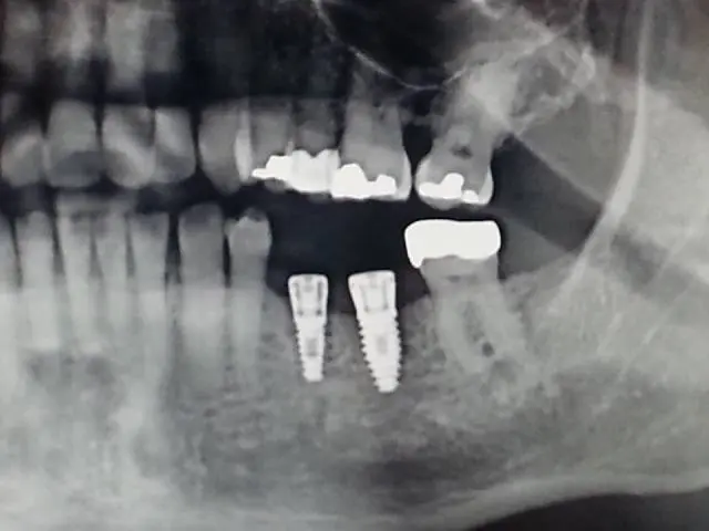 Affordable General Dentistry & Implants - Professional dental clinic exterior with modern facilities