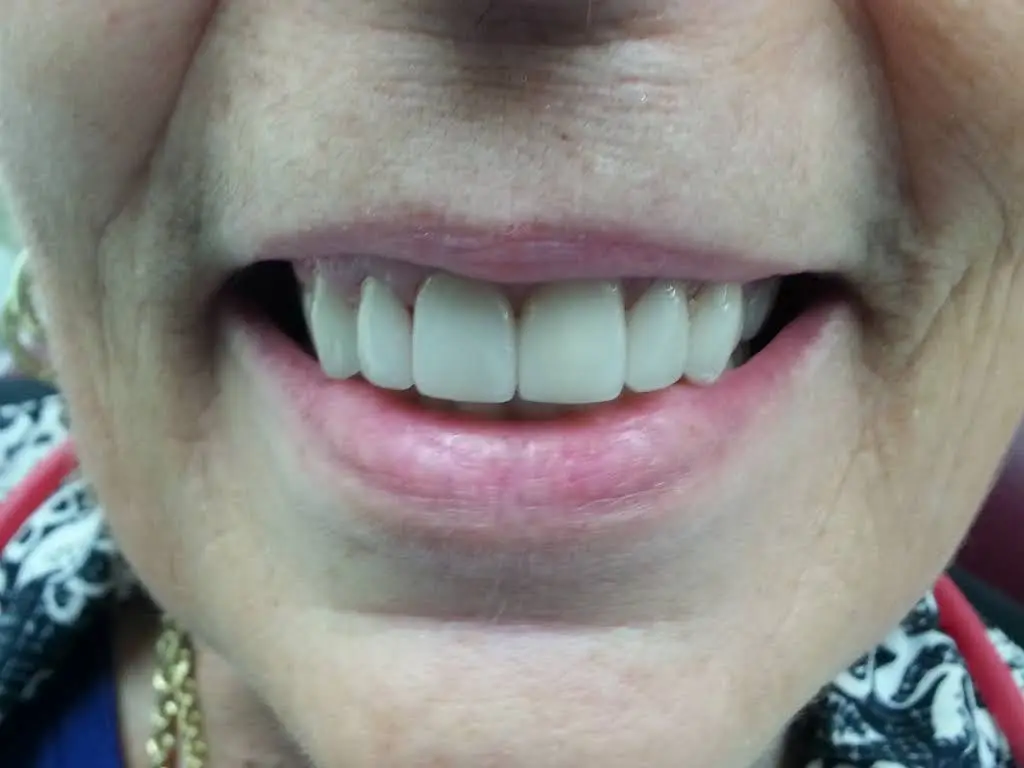 Affordable General Dentistry & Implants