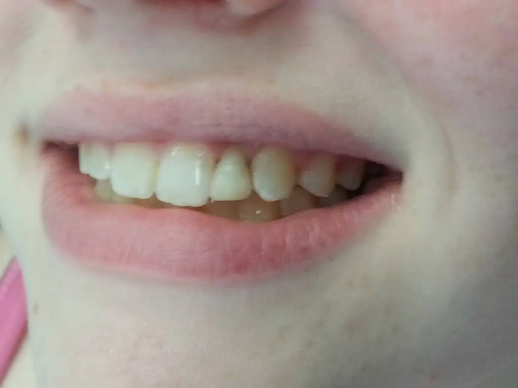 Affordable General Dentistry & Implants