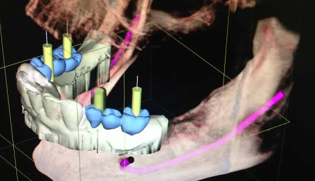 Advanced Endodontic Solutions