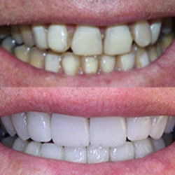 Village Smiles Family Dentistry