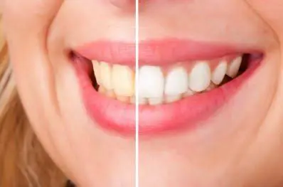 Lilac Family Dental