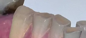 Aspen Dental
