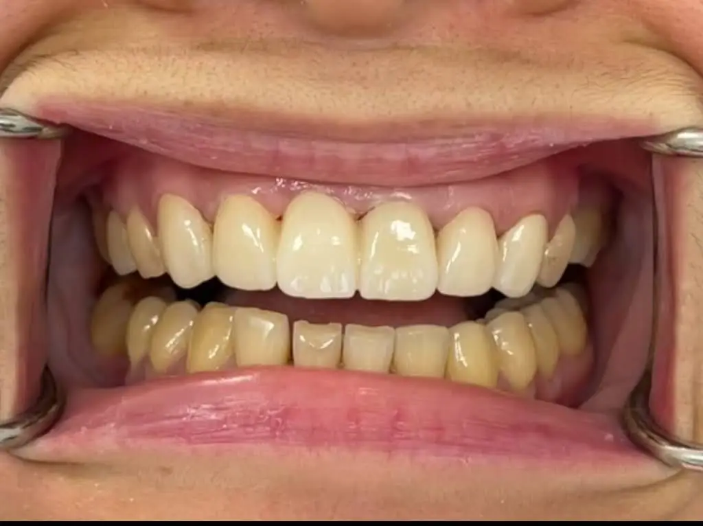 Dental Care Bridgewater