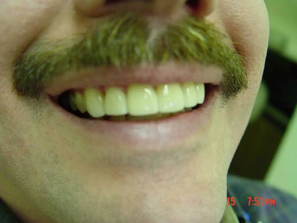 Caliber Dental