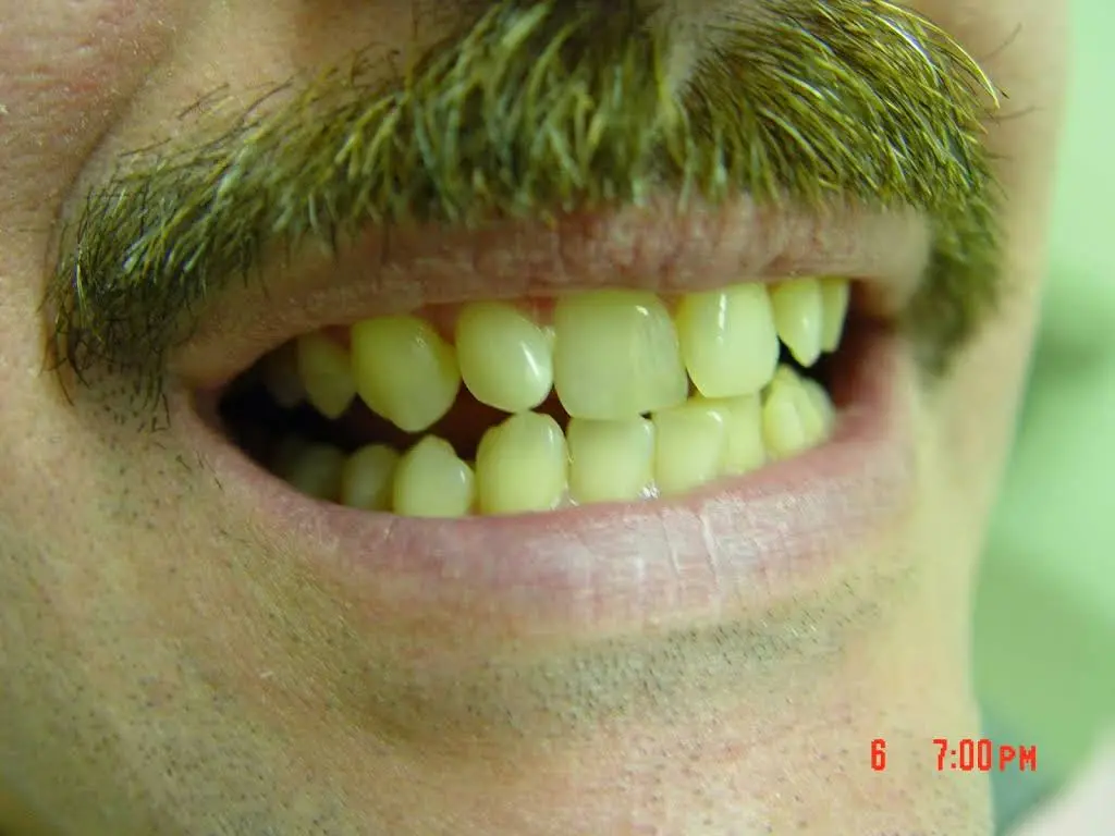 Caliber Dental