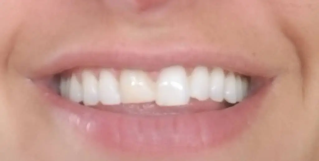 Morristown Cosmetic Dentistry: Victor Gittleman, DMD