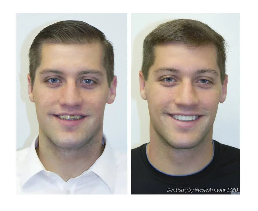 Armour Dentistry