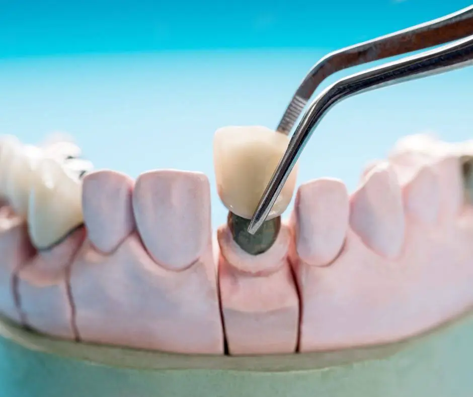 Champion Dentistry