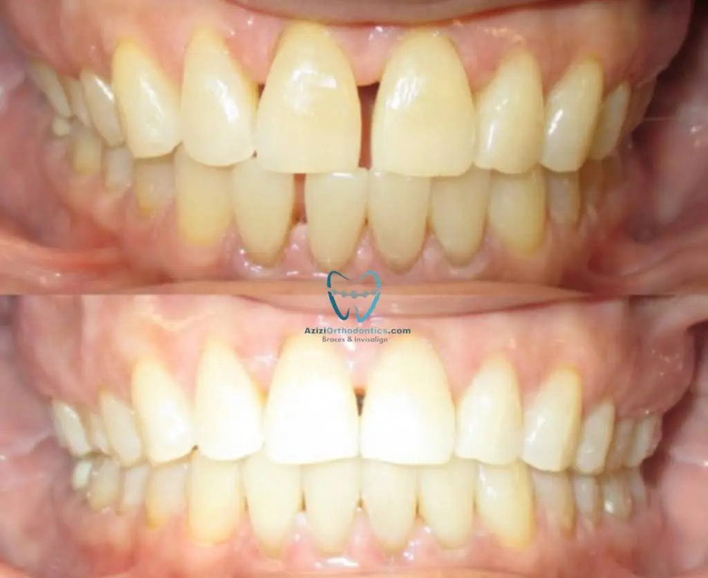 Azizi Orthodontics