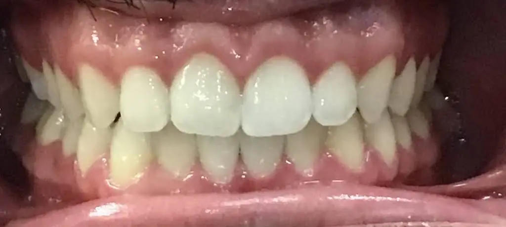 Team Dental - Swedesboro