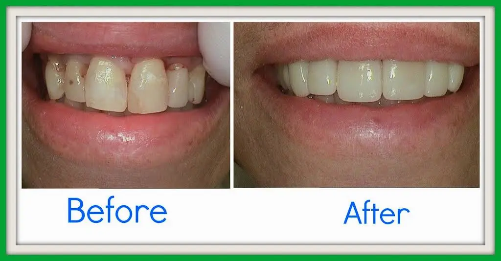 Team Dental - Swedesboro