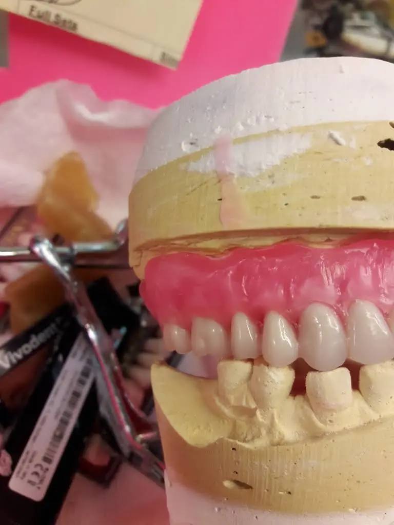 Affordable Dentures & Implants
