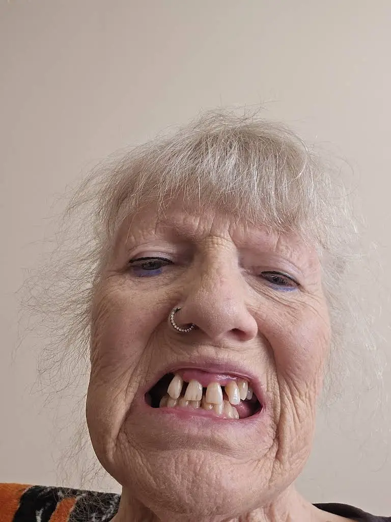 Affordable Dentures & Implants