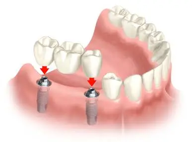 Pennsylvania Center for Advanced Dentistry - Dr. Olga Shvarts