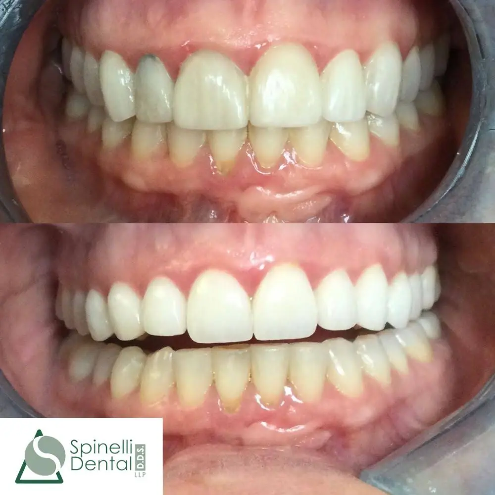 Spinelli Dental