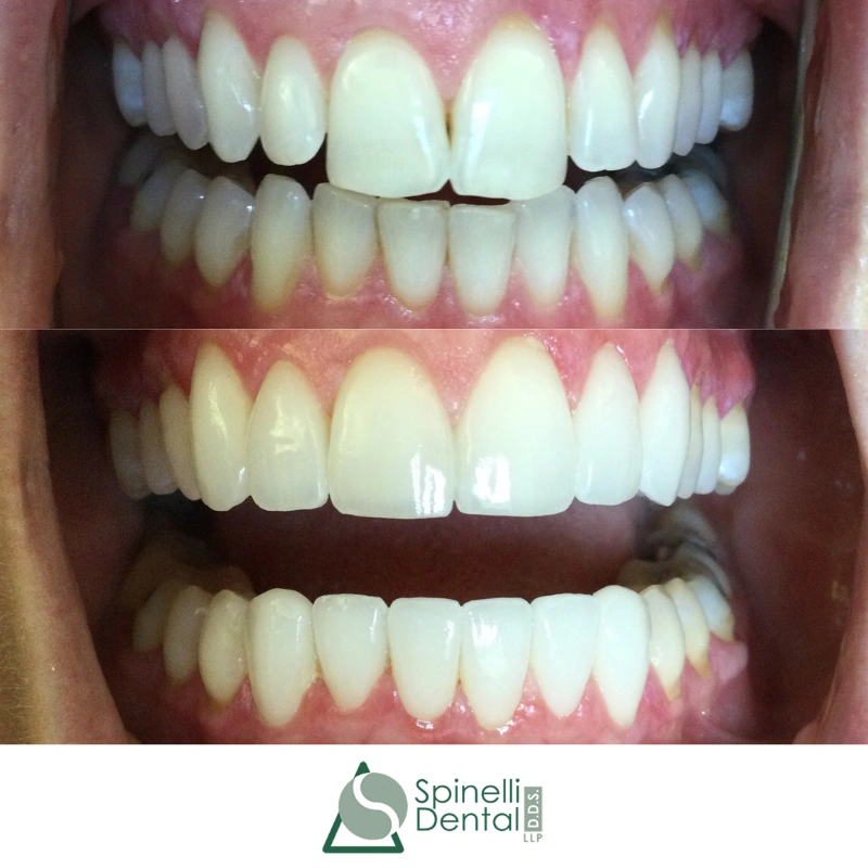 Spinelli Dental