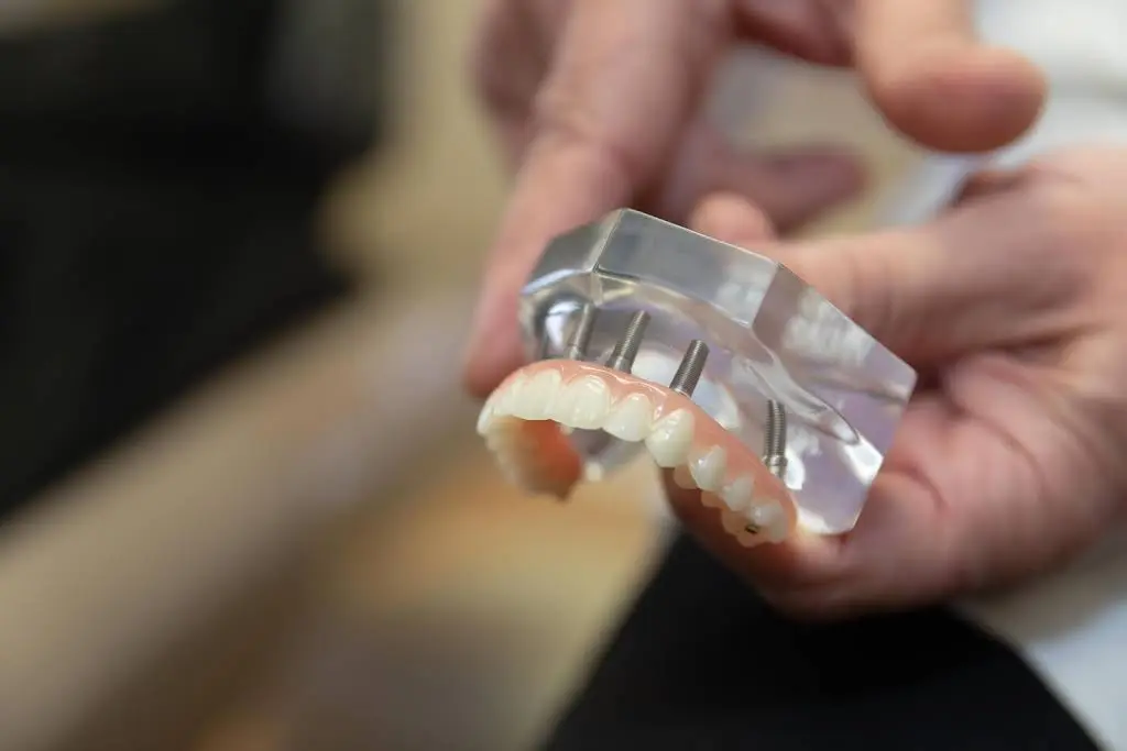 Cornerstone Dental - Cosmetic & Implant Dentistry