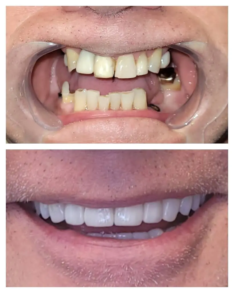 Designs for Dental Health