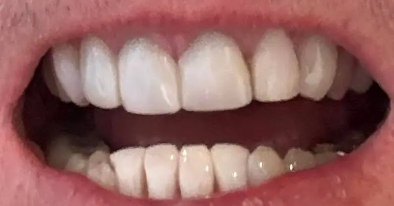 Vandenberg Dental