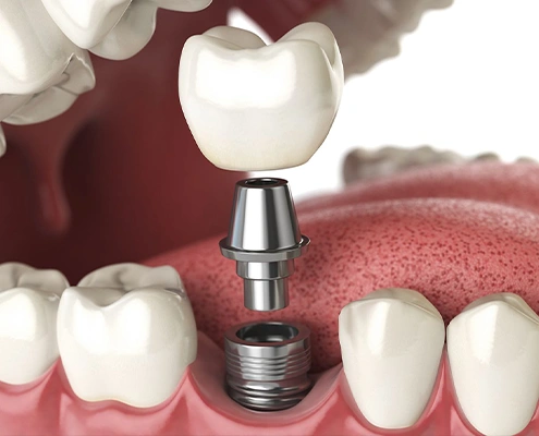 Dental Implants of Morris County - Professional dental clinic exterior with modern facilities