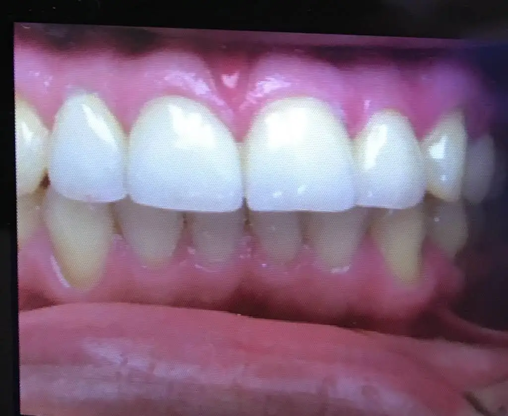 AV Dental