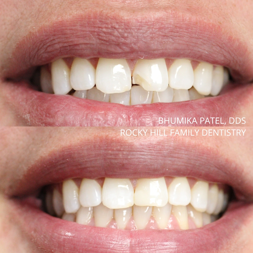 Rocky Hill Family Dentistry