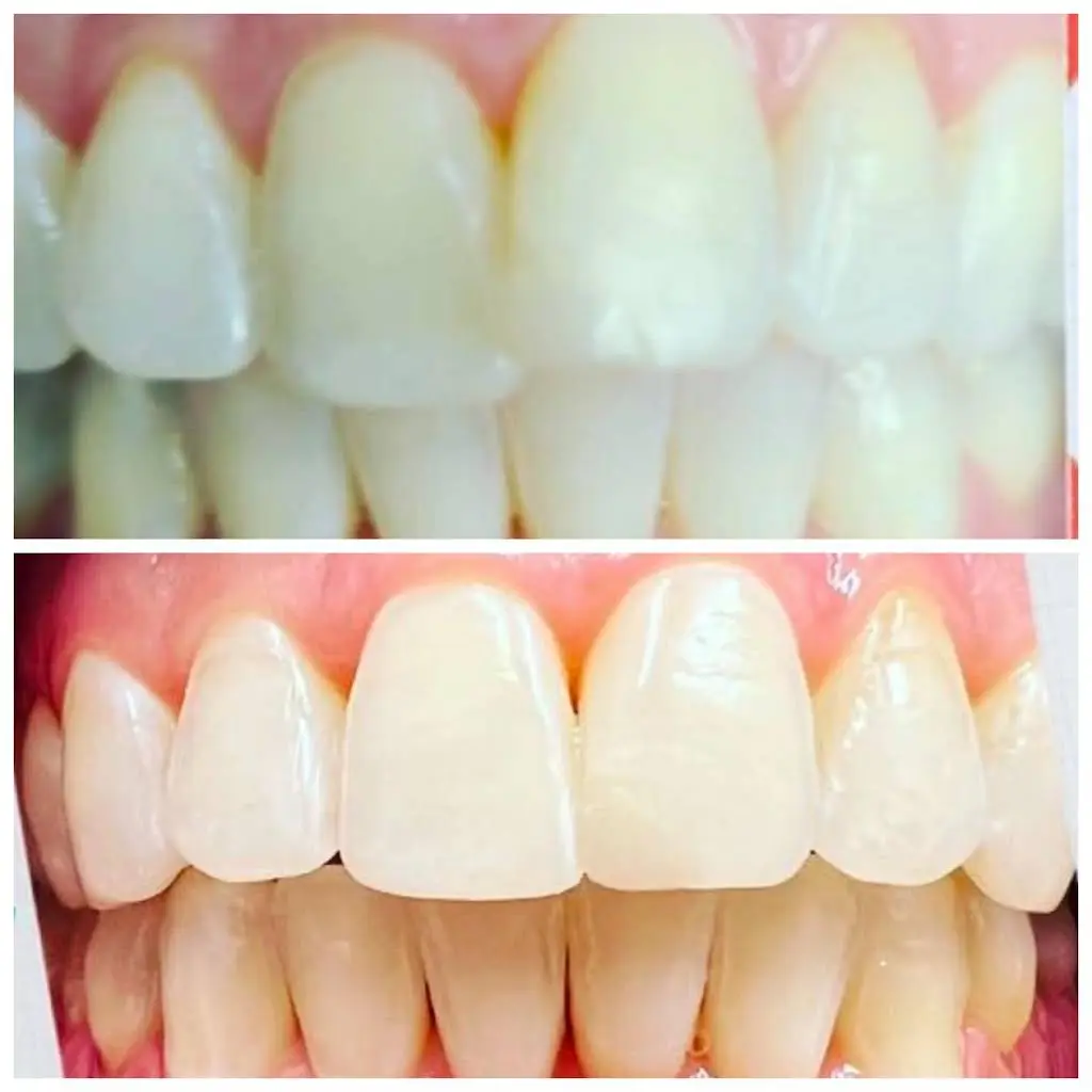 Montgomery Dental Loft