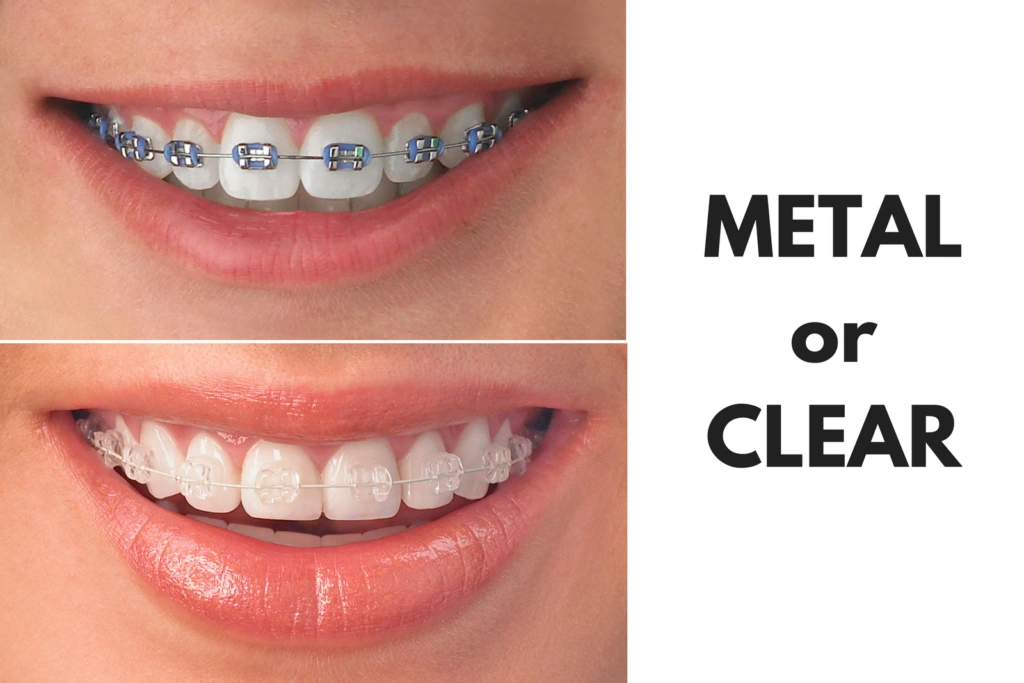 Charleston Orthodontic Specialists