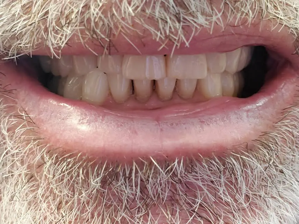 Cannon Park Dental - Dr. James Myers