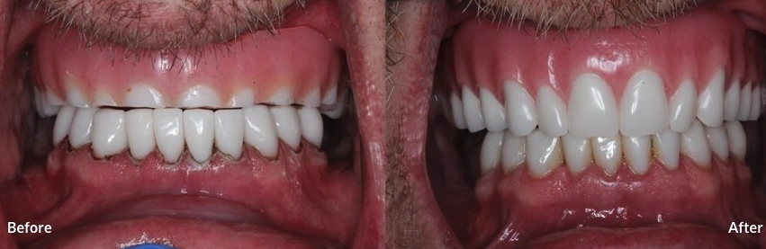 Ammons Dental by Design